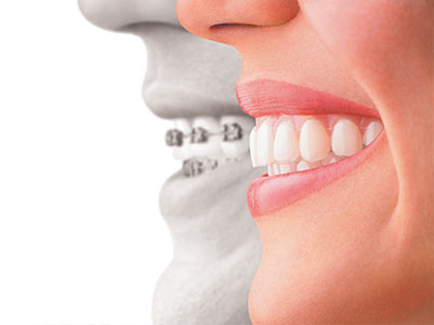 True Vine Dental Care | Implant Dentistry, Periodontal Treatment and Veneers