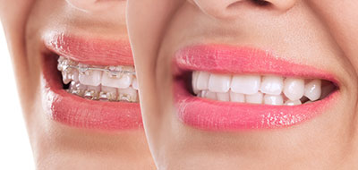 True Vine Dental Care | Periodontal Treatment, Oral Exams and Crowns