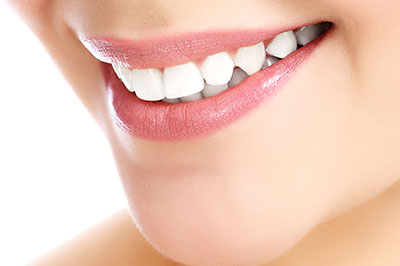 True Vine Dental Care | Implant Dentistry, Sports Mouthguards and Ceramic Crowns