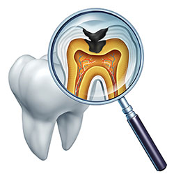 True Vine Dental Care | Invisalign reg , Veneers and Emergency Treatment