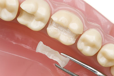 True Vine Dental Care | Crowns, All-on-4 reg  and Oral Cancer Screening