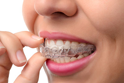 True Vine Dental Care | Ceramic Crowns, Dentures and Emergency Treatment