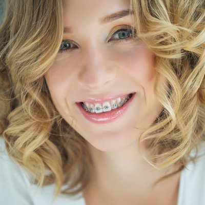 True Vine Dental Care | Oral Exams, Intraoral Camera and Invisalign reg 