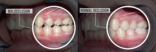 True Vine Dental Care | Crowns, Sports Mouthguards and Invisalign reg 