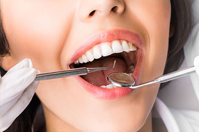 True Vine Dental Care | Cosmetic Dentistry, Dental Sealants and Teeth Whitening