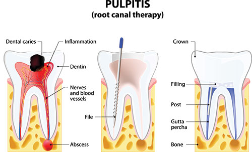 True Vine Dental Care | Oral Exams, Dentures and Veneers