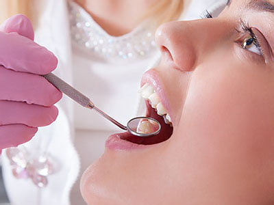 True Vine Dental Care | Ceramic Crowns, Implant Restorations and Oral Cancer Screening