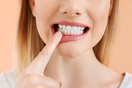 True Vine Dental Care | Veneers, Digital Radiography and Preventative Program